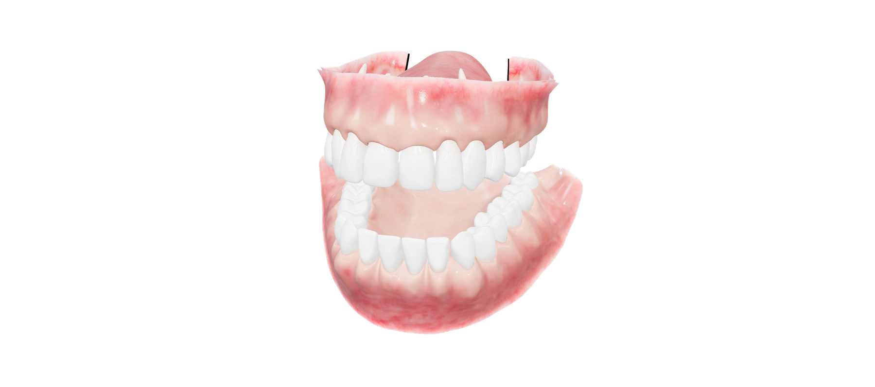 Odontograma de muestra