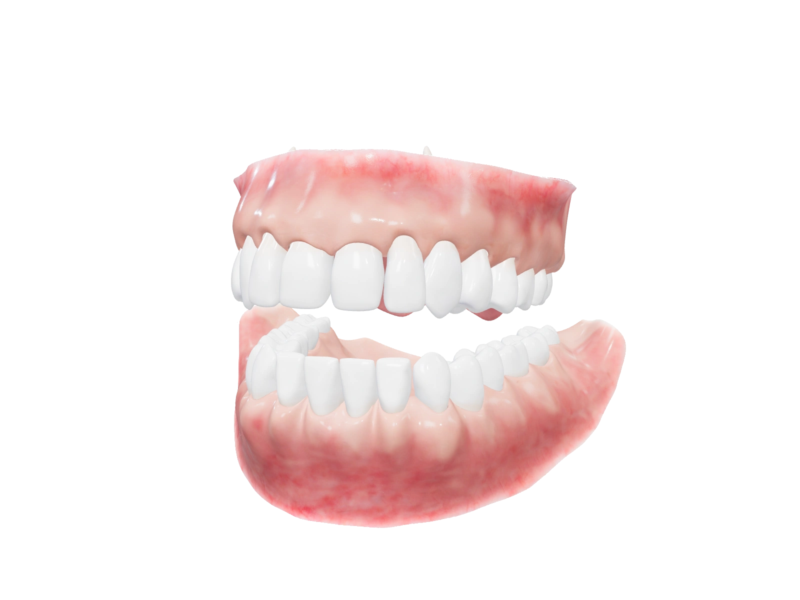 Las dos arcadas del odontograma tridimensional